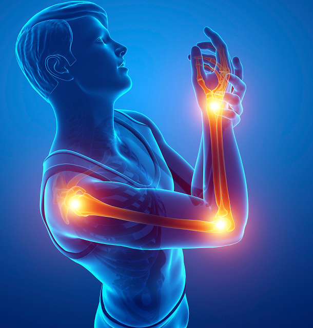 골프(테니스)엘보우